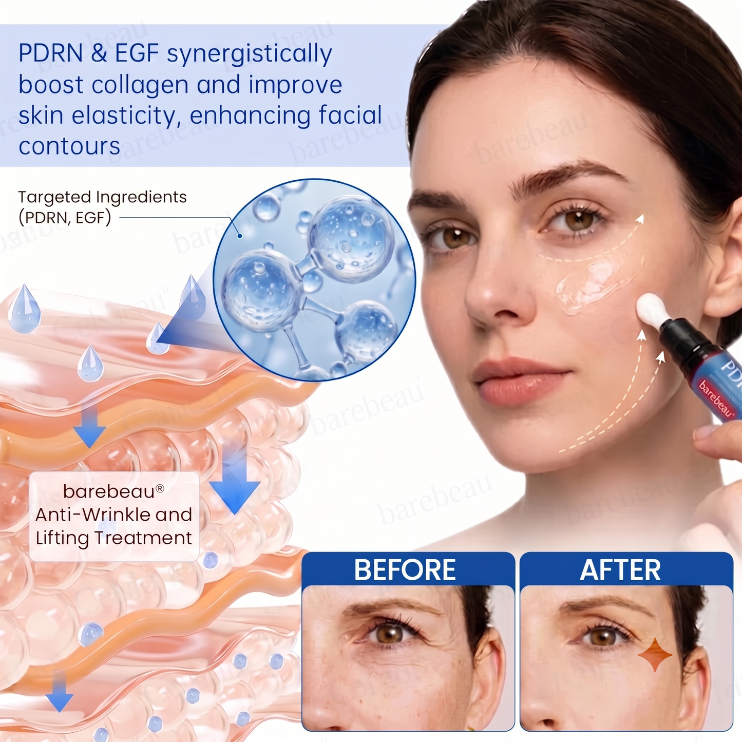 PDRN Anti-Wrinkle Shot – Lift & Firming Cream