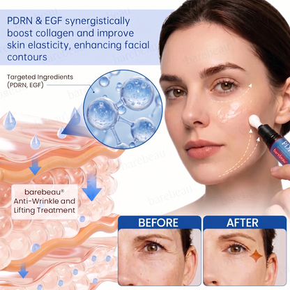 PDRN Anti-Wrinkle Shot – Lift & Firming Cream