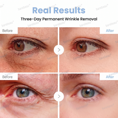 PDRN Anti-Wrinkle Shot – Lift & Firming Cream