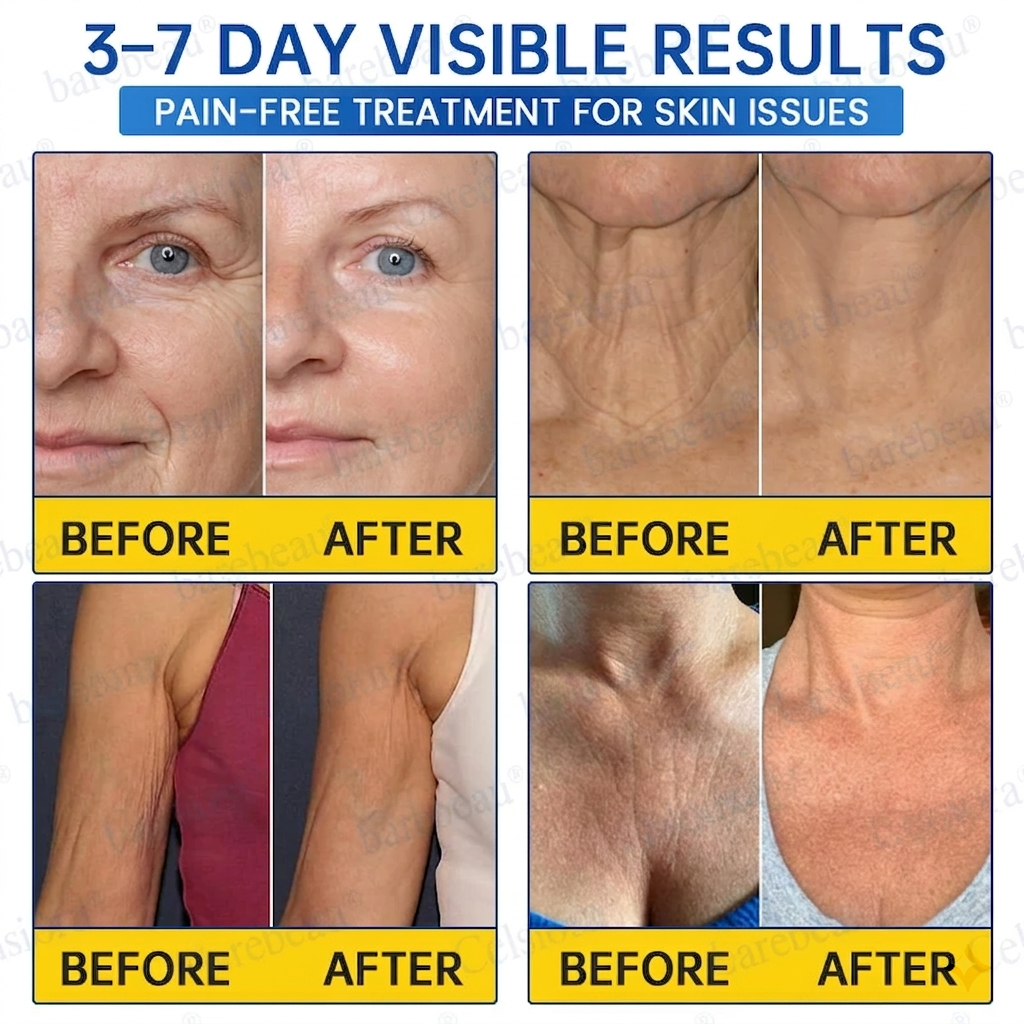 PDRN Anti-Wrinkle Shot – Lift & Firming Cream