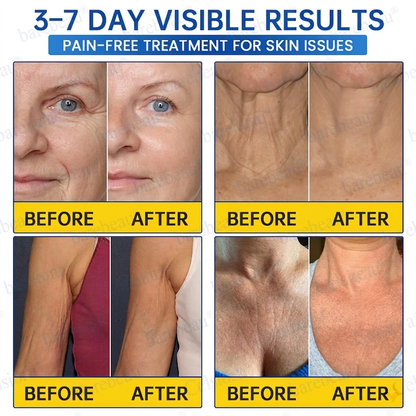 PDRN Anti-Wrinkle Shot – Lift & Firming Cream
