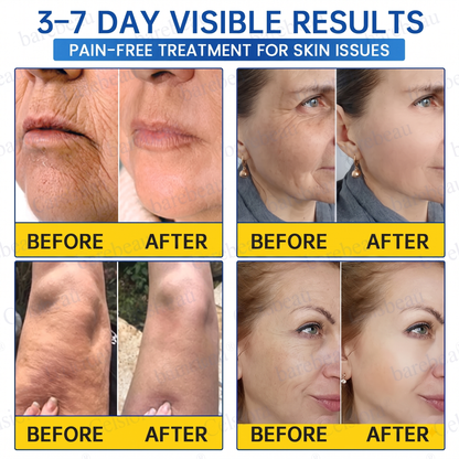 PDRN Anti-Wrinkle Shot – Lift & Firming Cream