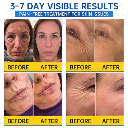 PDRN Anti-Wrinkle Shot – Lift & Firming Cream
